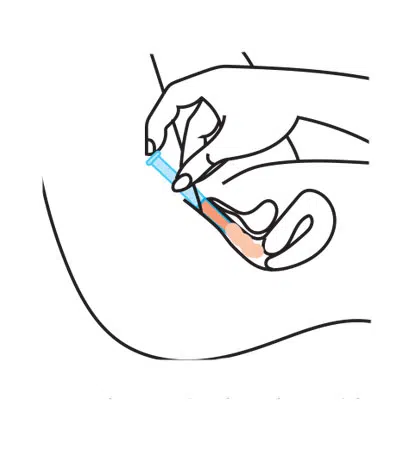 renorm-step-4